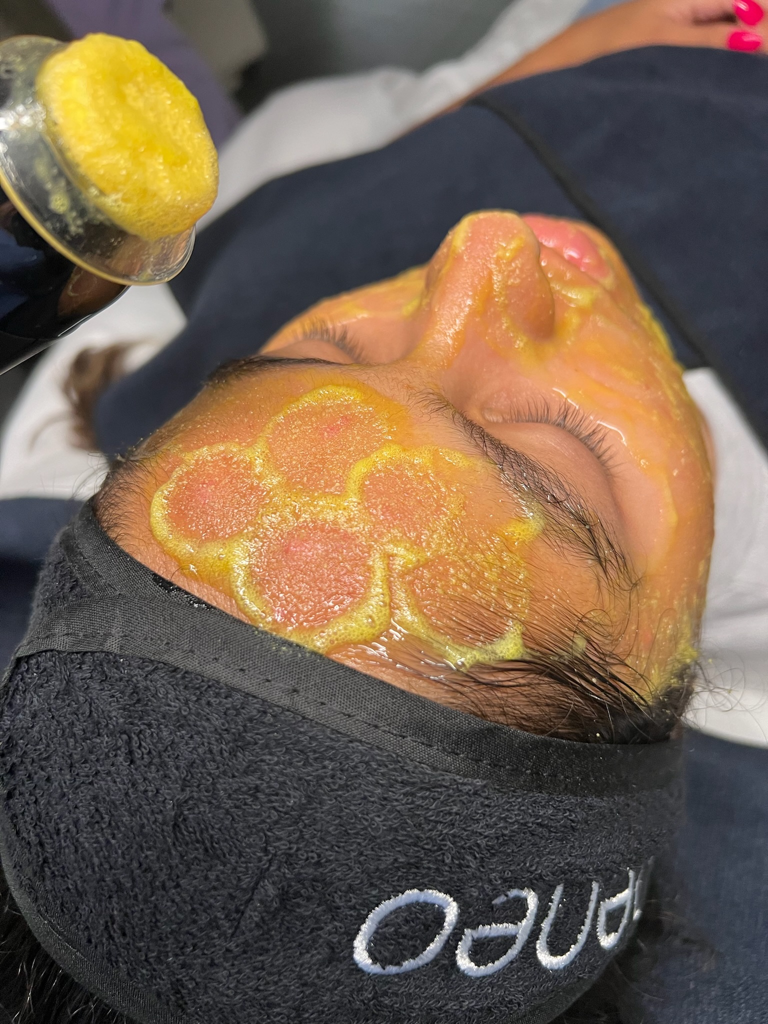 A close-up of a skincare treatment, showcasing a device applying a bright, orange gel to the skin. The background features vibrant colors